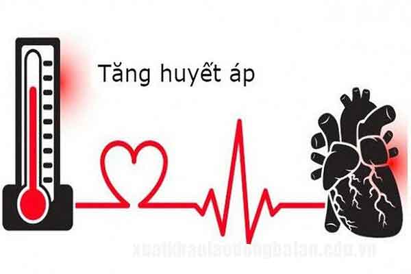 Huyết áp cao có đi xuất khẩu lao động được không