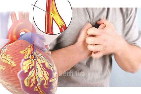 Bệnh tim có đi xuất khẩu lao động được không